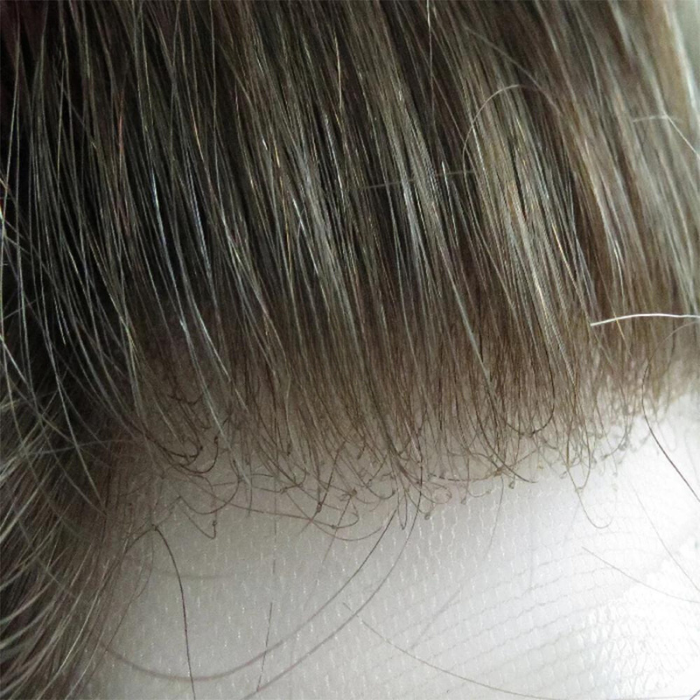 Home adhesive hair prosthesis - lace
