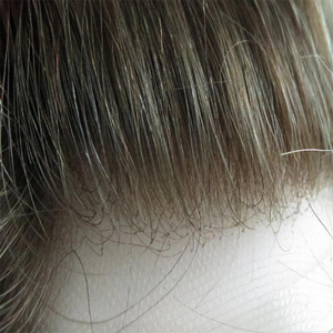 Home adhesive hair prosthesis - lace